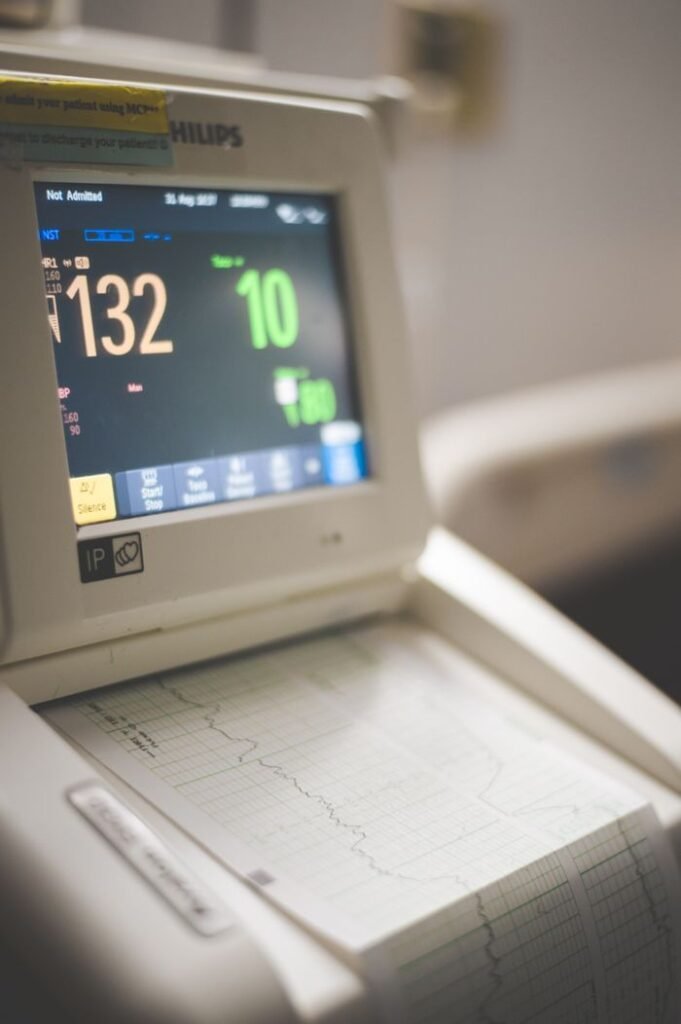Close-up view of an ECG monitor displaying patient vitals and printed graphs.